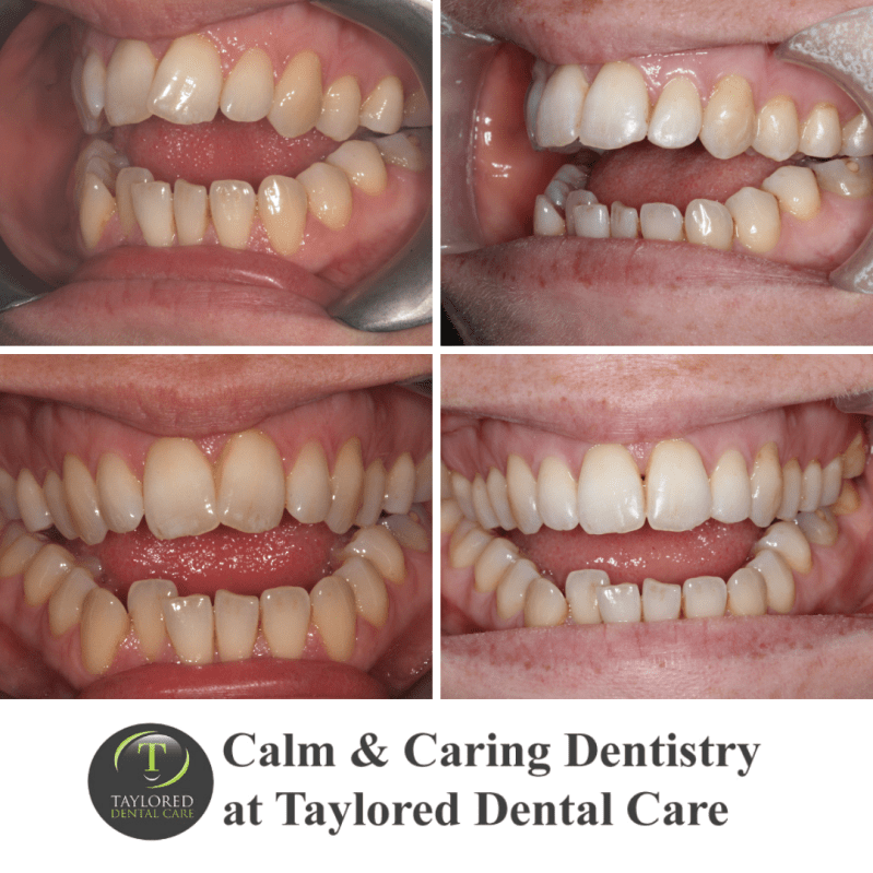 Changing smiles at Taylored Dental